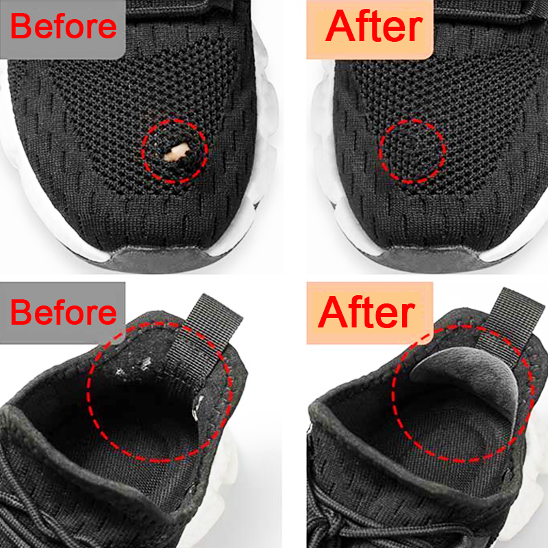 Sports Shoes Patches Vamp Repa - Sports Equipment Repair บทวิจารณ์และราคา